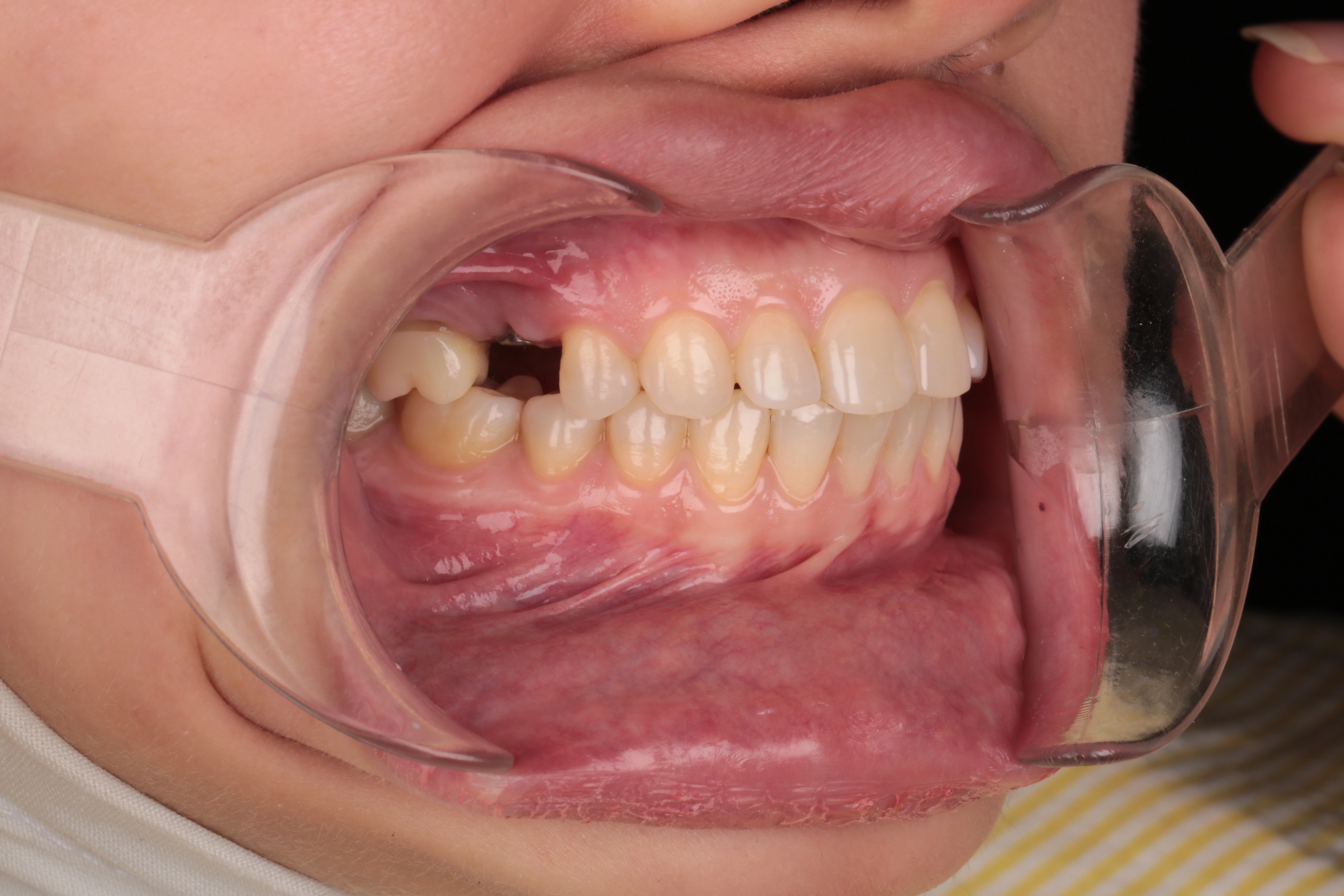 Before Image
